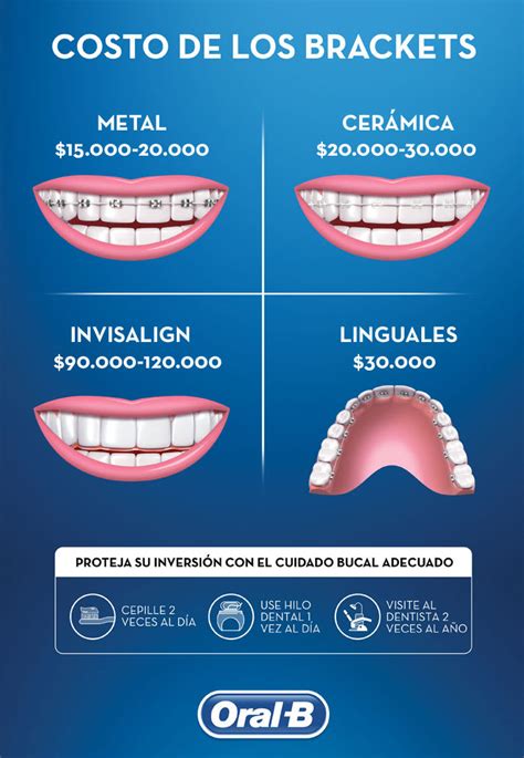 costo de brackets metalicos en mexico|precio de los brackets.